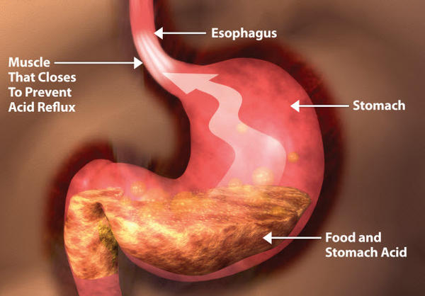 The Lowdown on Stomach&nbsp;Acid!